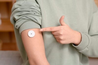 持続血糖測定器（Dexcom G7）の選定療養についてのアイキャッチ画像